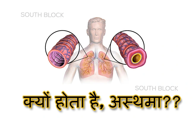 क्यों होता है, अस्थमा(क्रोनिक रेस्पिरेटरी डिसीसेस)