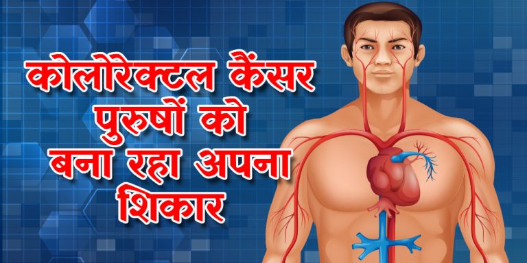 महिलाओं के साथ-साथ पुरुषों को भी अपना शिकार बना रहा है कोलोरेक्टल कैंसर, जानिए लक्षण
