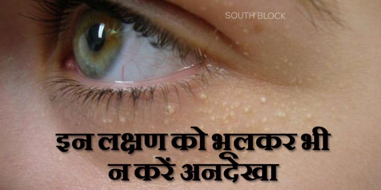 Cholesterol Symptoms on Skin