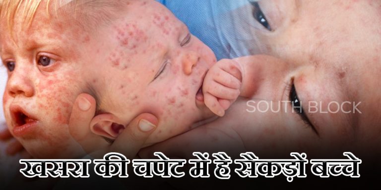 Measles Disease alert