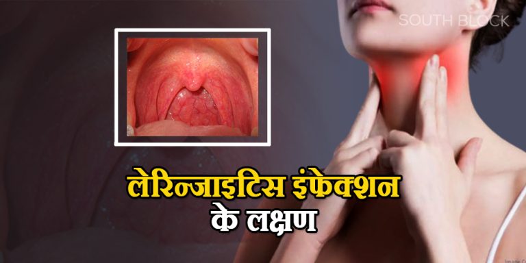 Laryngitis Causes Symptoms