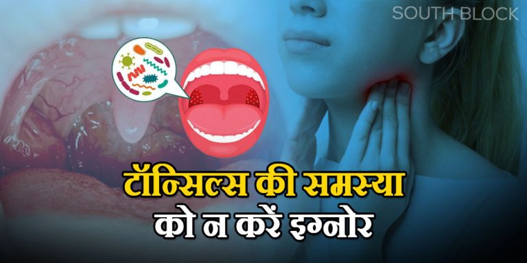 Tonsil Cancer Symptoms