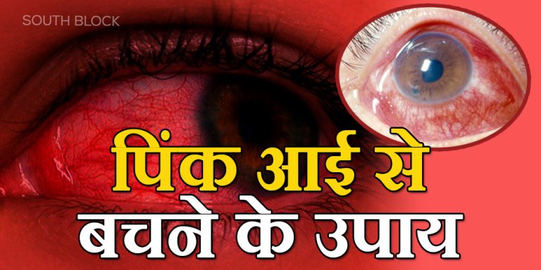 Conjunctivitis Prevention