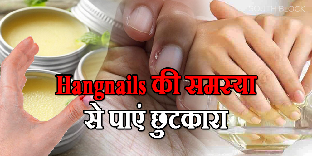 Remedies For Hangnails