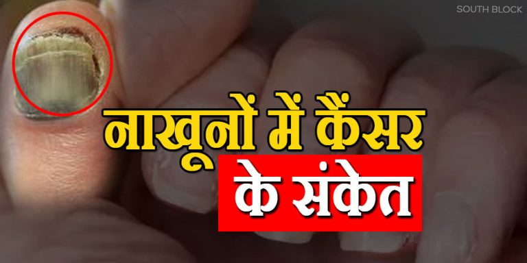 Signs of Cancer are found in Nails