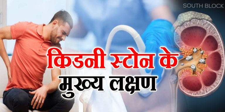Kidney Stone Symptoms