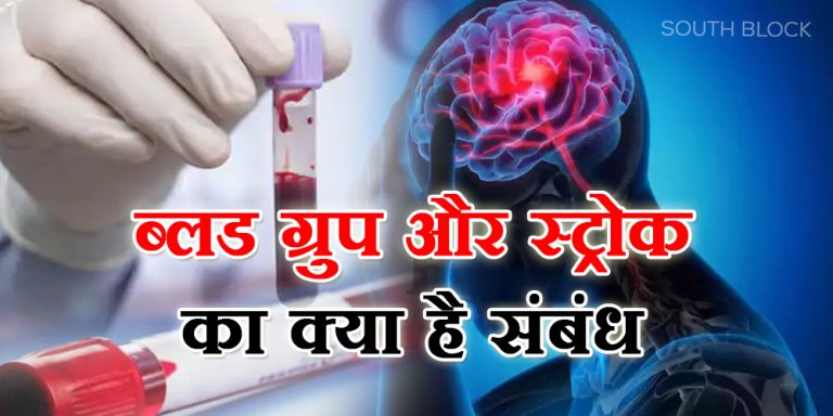 Stroke Risk