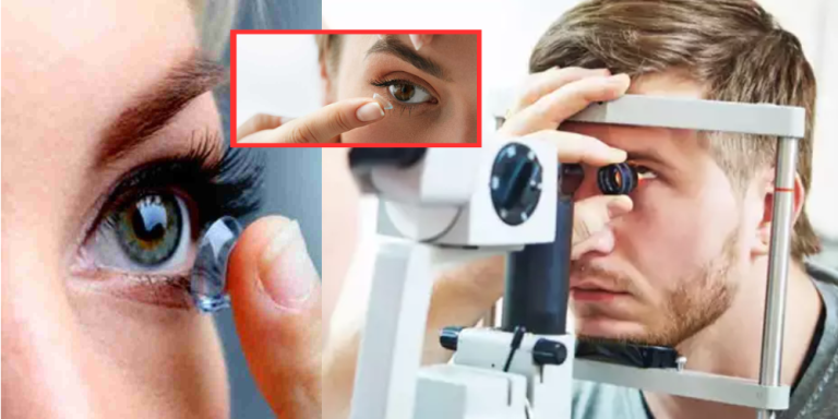 Contact Lens Side Effects