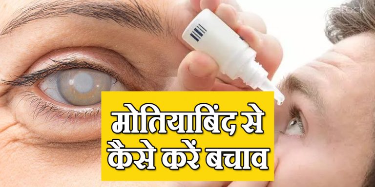 Eye Cataract Symptoms, Causes & Prevent