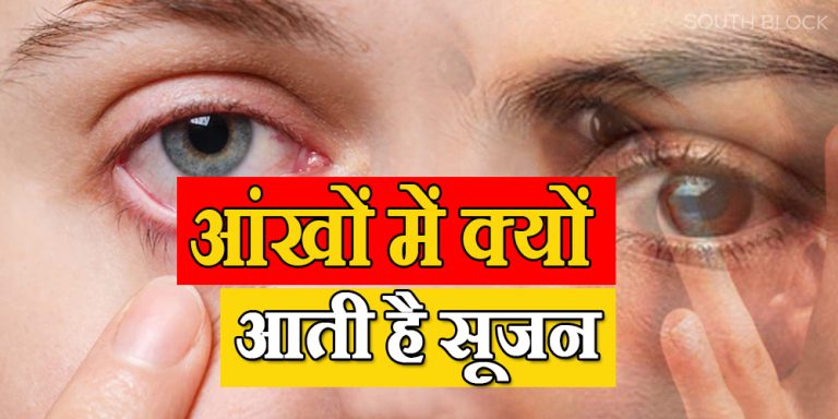 Puffiness under the eyes