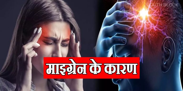 Migraine Causes