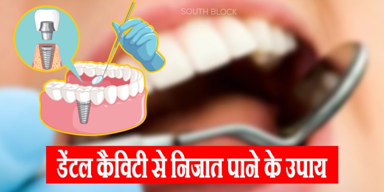 Dental Cavity Home Remedies