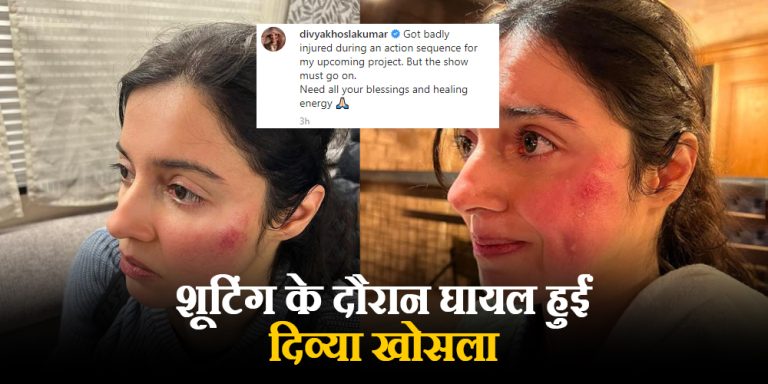 Divya Khosla Kumar Injured
