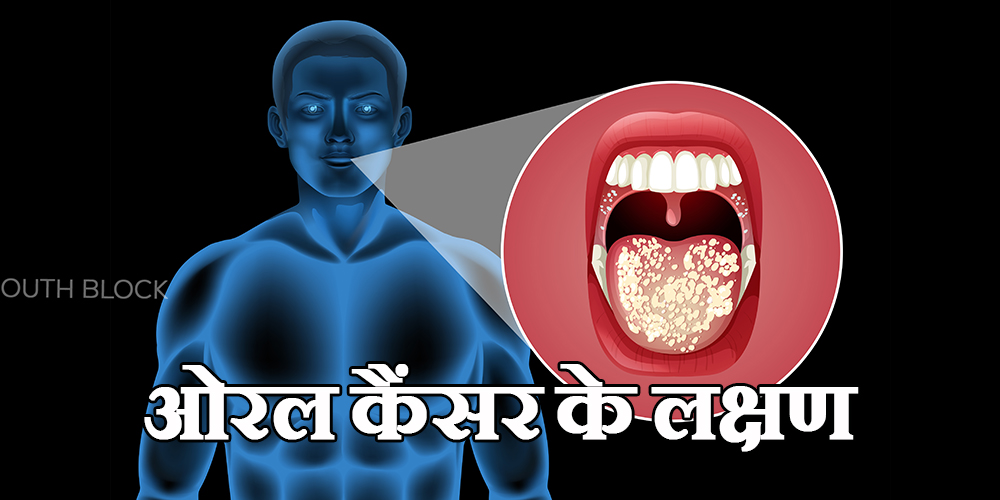 Oral Cancer Symptoms