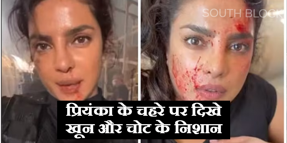  Priyanka Chopra: प्रियंका के चहरे पर दिखे खून और चोट के निशान, सोशल मीडिया पर शेयर किया वीडियो